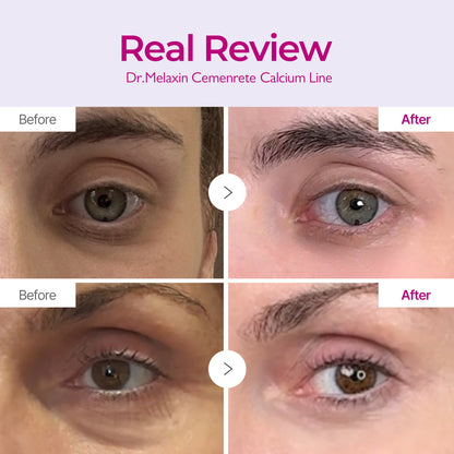 [Dr.Melaxin Official] Calcium Eyecare Routine Set