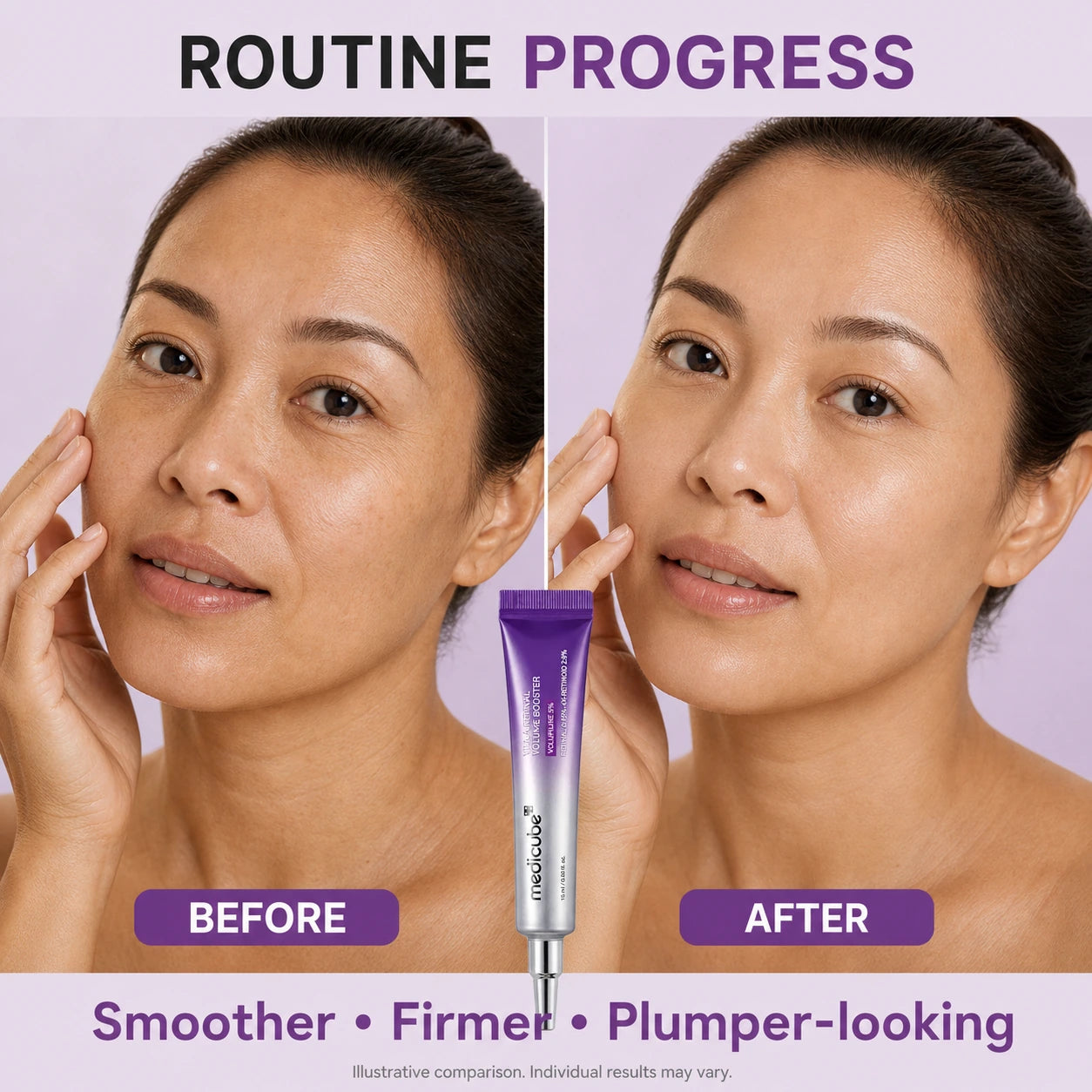[NEW] [medicube] Vita A Retinal Volume Booster | Retinal + Volufiline + 4X-Retinoid + 4X Micro Boost | Anti-aging, Plumping | Care for Pores, Look of Fine Lines, Skin Elasticity & Firmness For Smoother, Firmer & Youthful-looking Skin | Korean Skincare