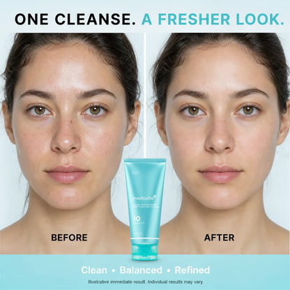 [NEW] Azelaic Acid Gummy Whip Cleanser | Cleansing Foam For Troubled Skin | Use After Spot Care & Excess Sebum Control | Niacinamide, Glycerin | Soothing, Pore Cleansing Face Wash | Korean Skincare