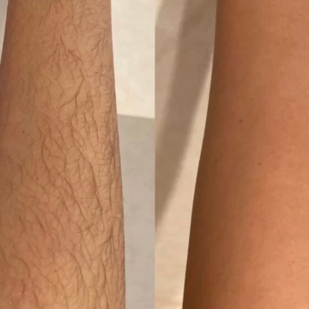 Flamingo Body Hair Removal Cream - Gentle Formula - 200ml - Iris & Suede Scented - Safe Up to 7 Days - Includes Spatula for Touch-Free Application