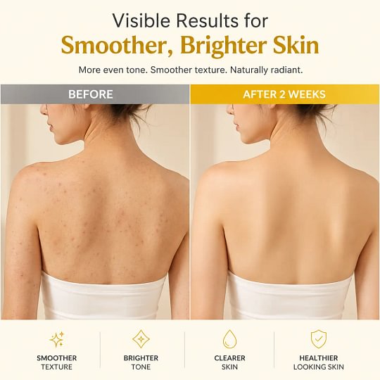 [medicube] Smooth & Clear Body Care Set | Hypochlorous Acid Body Peel Shot, Kojic Acid Turmeric Body Wash, Toner Pad, Toner, Mist | Exfoliating for Dead Skin Cells & Excess Sebum & Clearing for After Spots, Texture & Uneven Skin Tone | K-Beauty