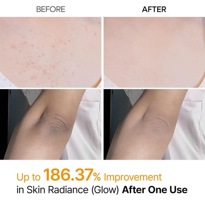 🔥[5𝟎% 𝐎𝐅𝐅 𝐋𝐀𝐒𝐓 𝐓𝐇𝐑𝐄𝐄 𝐃𝐀𝐘𝐒]Dr.melaxin Peel Shot Keratin Care Kojic Acid Turmeric Spray 200ml Pore Clearing Exfoliating Formula Skin Repair Scrub
