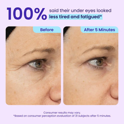 🏆NEW! GOPURE Instant Lift Eye Gel - For Puffiness & Bags, Wrinkles, Fine Lines and Dark Circles, Anti Aging Skin Care for Men & Women with Collagen Targeting Biotech