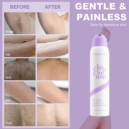 PHOFAY Hair Removal Cream for Sensitive Skin – Fast-Acting, with Aloe & Hyaluronic Acid Spray Depilatory Dermatologist-Recommended