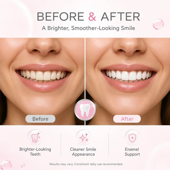 Hismile Tooth Armour Fluoride Free Toothpaste Serum, Nano Hydroxyapatite Toothpaste, Appropriate for Sensitive Teeth, Supports Tooth Enamel, Niacinamide Toothpaste, Advanced Enamel Support | 20 ml