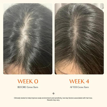 Hair Growth Serum with Built in Brush for Hair Growth & Thickening