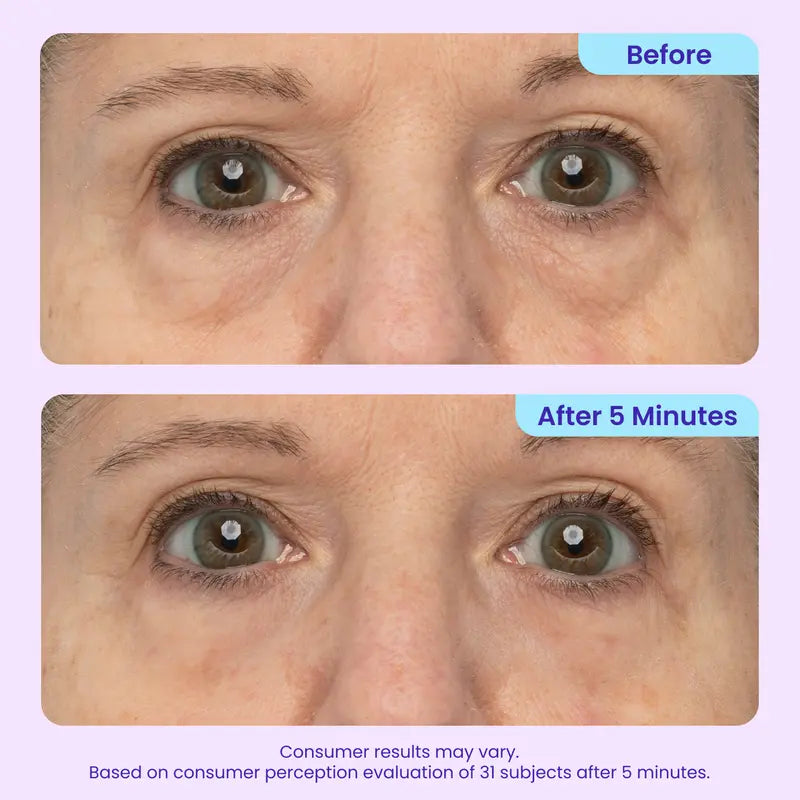 🏆NEW! GOPURE Instant Lift Eye Gel - For Puffiness & Bags, Wrinkles, Fine Lines and Dark Circles, Anti Aging Skin Care for Men & Women with Collagen Targeting Biotech