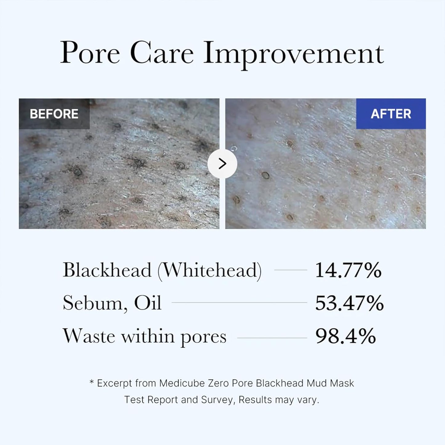 Zero Pore Blackhead Mud Mask | 3 min mud mask | pore care | Strong Blackhead Absorption