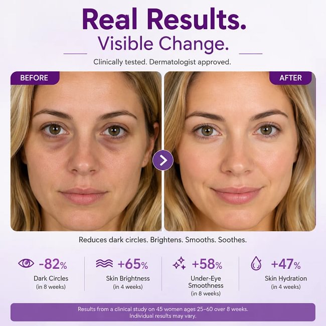 Dr.Melaxin Cemenrete Calcium Crema de ojos para manchas oscuras | Ojeras, antiedad, flacidez, elasticidad | Cosmética coreana