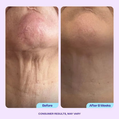 GOPURE Neck Cream Tighten & Lift Firming Cream for Crepey Skin