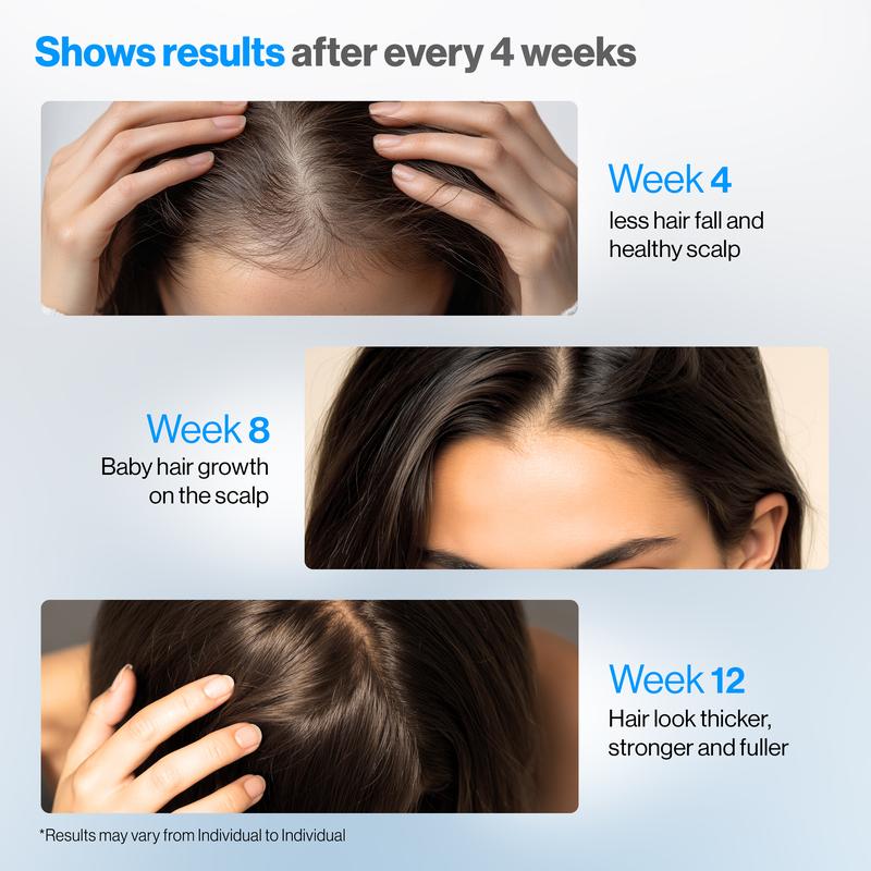 ✨  Bodywise Hair Growth Serum Roll-On – Boosts Roots, Revives Thinning Hair Naturally