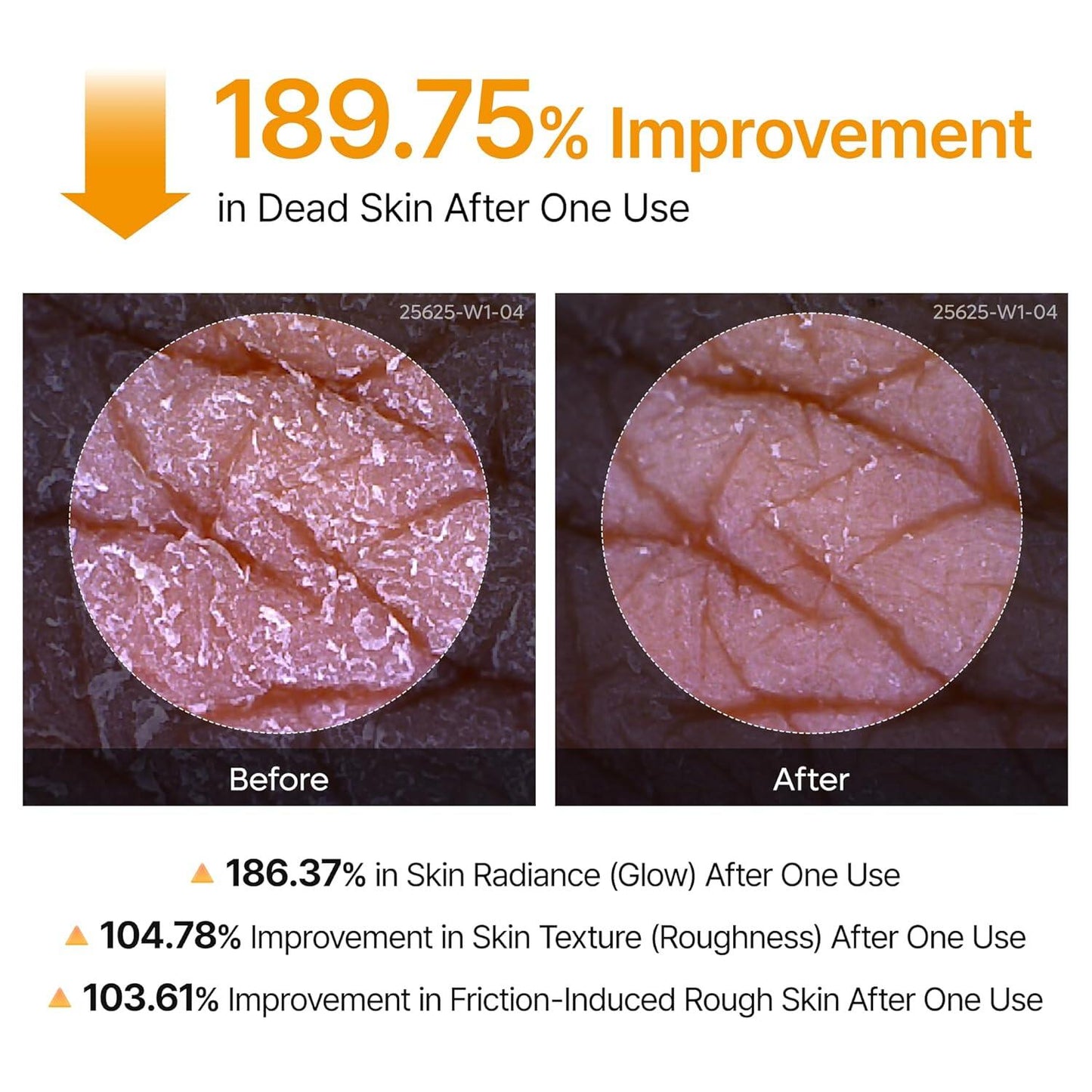🔥[5𝟎% 𝐎𝐅𝐅 𝐋𝐀𝐒𝐓 𝐓𝐇𝐑𝐄𝐄 𝐃𝐀𝐘𝐒]Dr.melaxin Peel Shot Keratin Care Kojic Acid Turmeric Spray 200ml Pore Clearing Exfoliating Formula Skin Repair Scrub