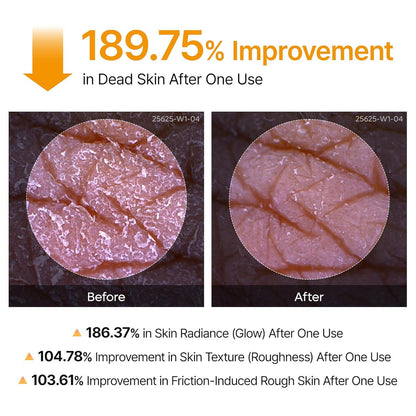 🔥[5𝟎% 𝐎𝐅𝐅 𝐋𝐀𝐒𝐓 𝐓𝐇𝐑𝐄𝐄 𝐃𝐀𝐘𝐒]Dr.melaxin Peel Shot Keratin Care Kojic Acid Turmeric Spray 200ml Pore Clearing Exfoliating Formula Skin Repair Scrub