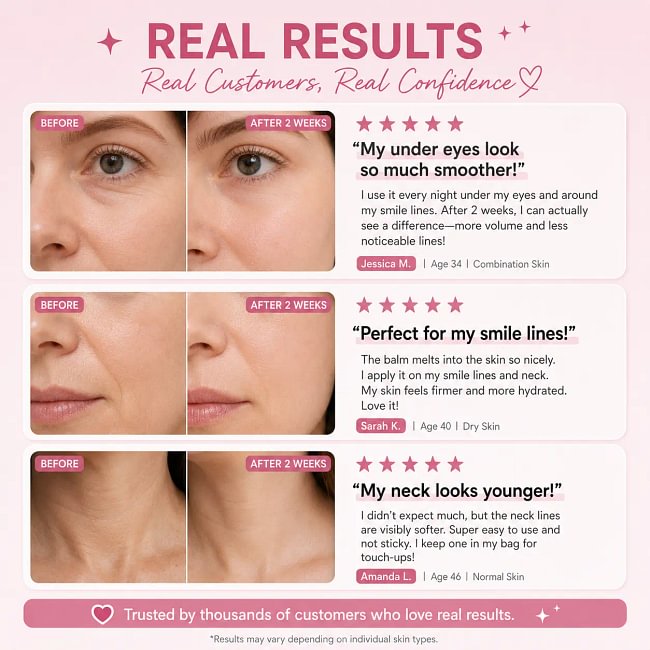 [NEW] [medicube] PDRN Pink Collagen Volume Multi Balm | All In One Volufiline, PDRN, NAD Stick for Youthful-Looking, Helping Look of Fine Lines, Firming Care, Anti-Aging Care | For Under-Eyes, Neck, Forehead, Smile Lines, Lip Care | Korean Skincare