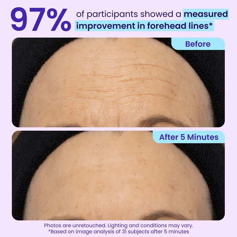 🏆NEW! GOPURE Instant Lift Eye Gel - For Puffiness & Bags, Wrinkles, Fine Lines and Dark Circles, Anti Aging Skin Care for Men & Women with Collagen Targeting Biotech